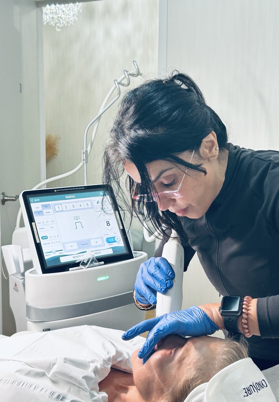 The Potenza RF microneedling device interface used at Pureté Medical Spa